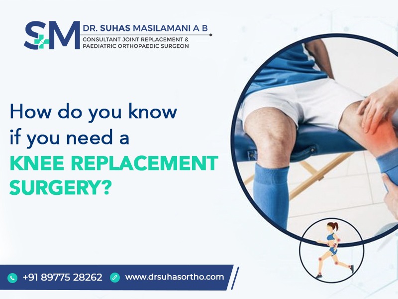 How Do You Know If You Need a Knee Replacement Surgery?