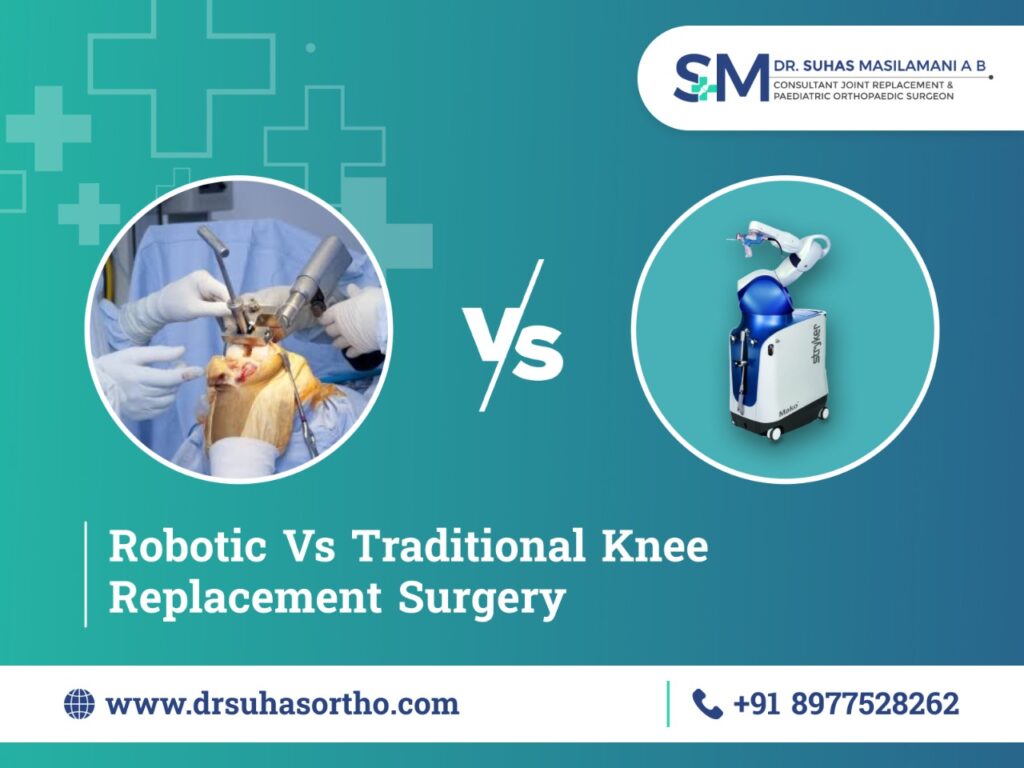 Robotic Vs Conventional Knee Replacement Surgery